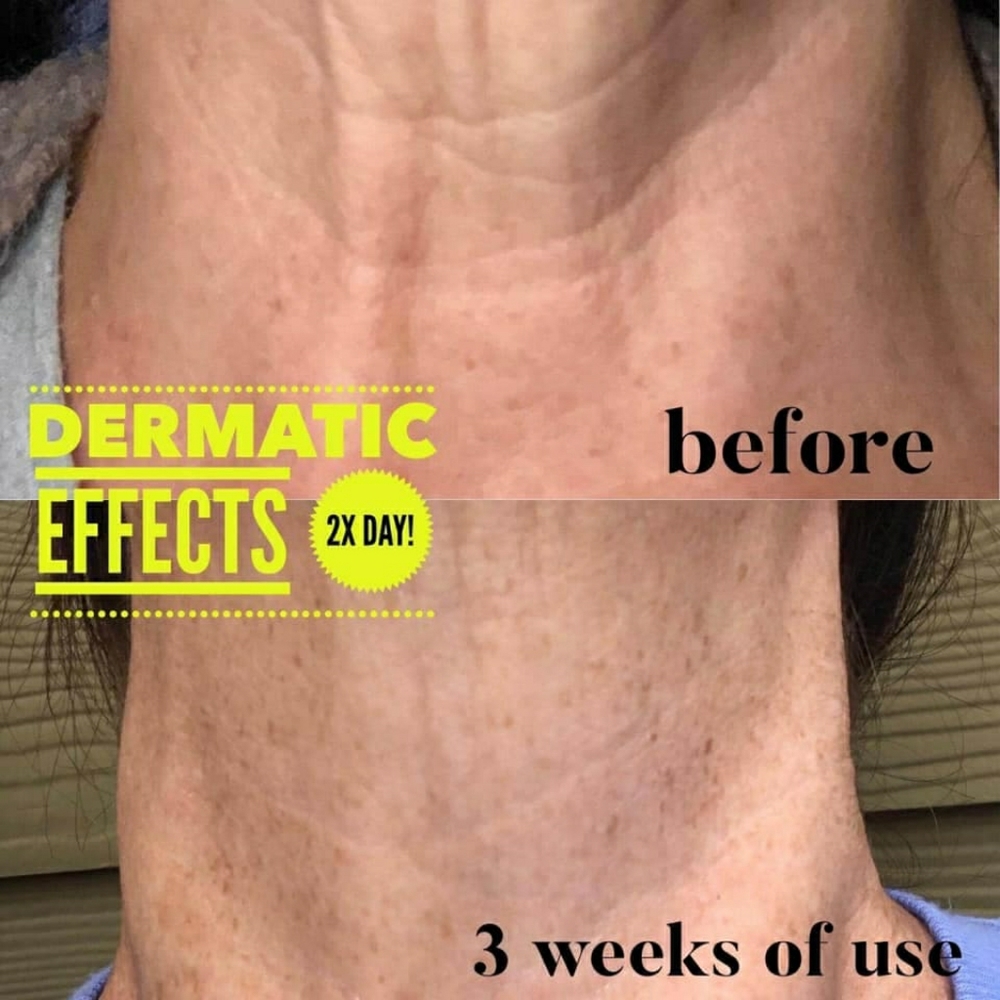 Dermatic Effects firming cream